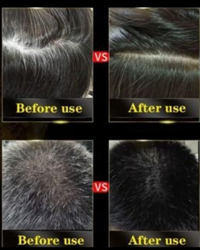 BLOSDREAM Black Hair Shampoo 3 in 1-100ml (Pack of 2)